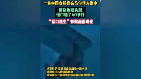 一名中国女游客在马尔代夫潜水,遭鲨鱼咬头部,伤口缝了40多针,"鲨口