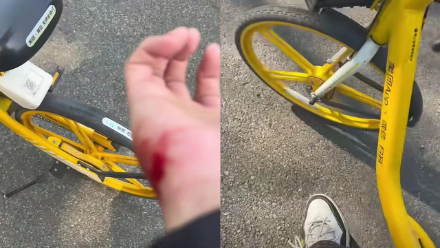 男生吐槽骑共享单车时踏板突然锁死致人被甩飞身上多处摔伤