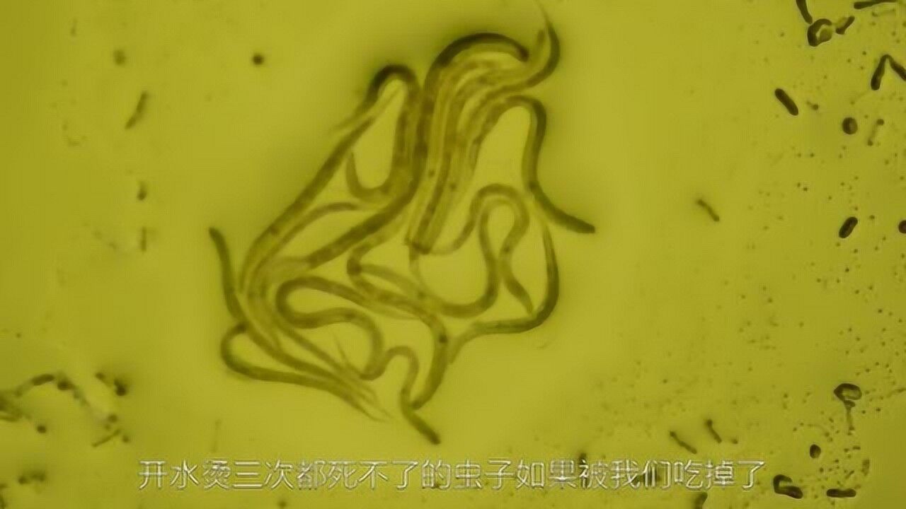 黄鳝里面的寄生虫图片图片
