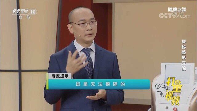 激光祛斑真的能永久除斑吗?专家:斑是无法根除的