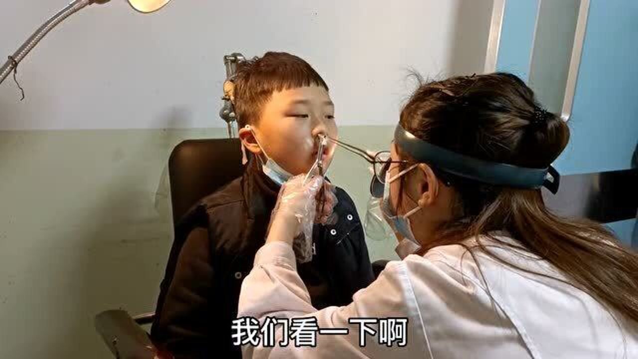 8岁孩子腺样体肥大保守治疗3年，鼻镜检查出来，后悔没早点做手术_高清