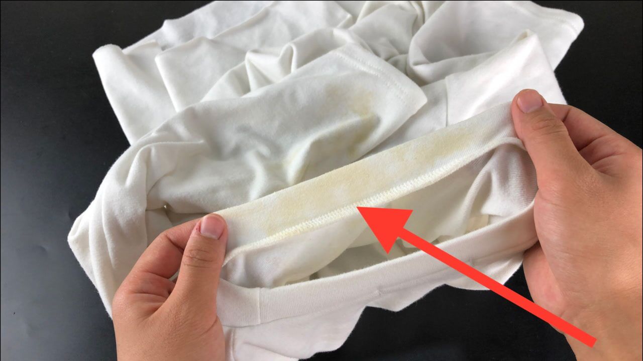 白衣服发黄怎么去除_白衣服发黄怎么去除小妙招-第2张图片-潮百科