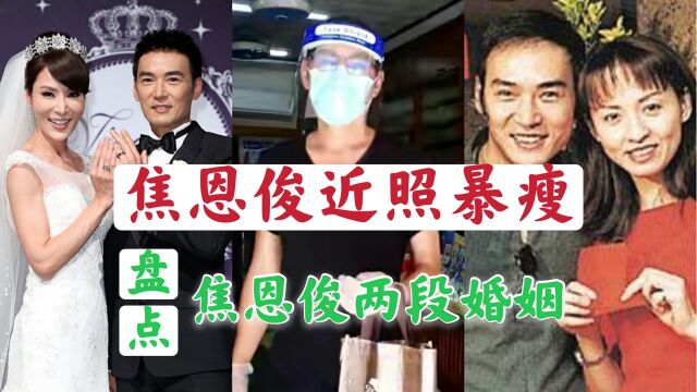 53岁焦恩俊近照暴瘦!小腿伤疤太抢镜,盘点焦恩俊两段婚姻