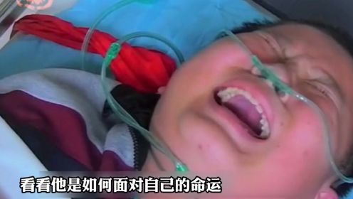 13岁男孩左脚被碾碎，男孩撕心裂肺说出三个字，医生也被感动哭