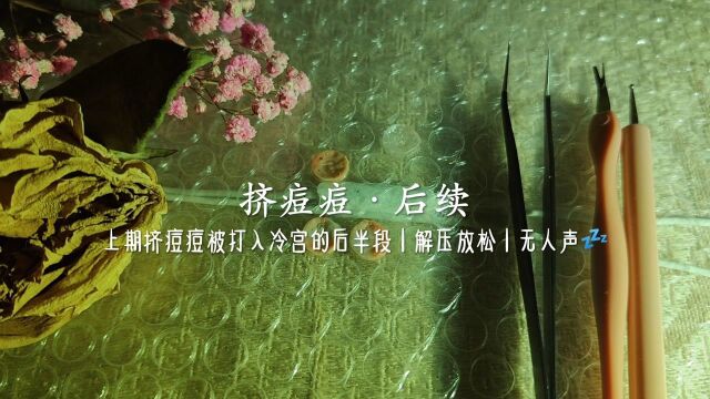 模拟ⷮŠ挤痘痘后续|被打入冷宫的版本|解压