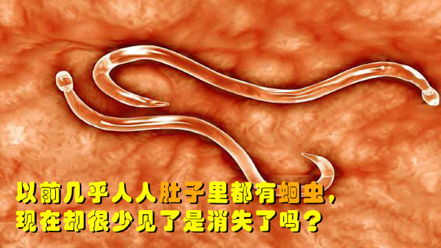 以前几乎人人肚子里都有蛔虫,为什么现在很少人有?难道消失了?