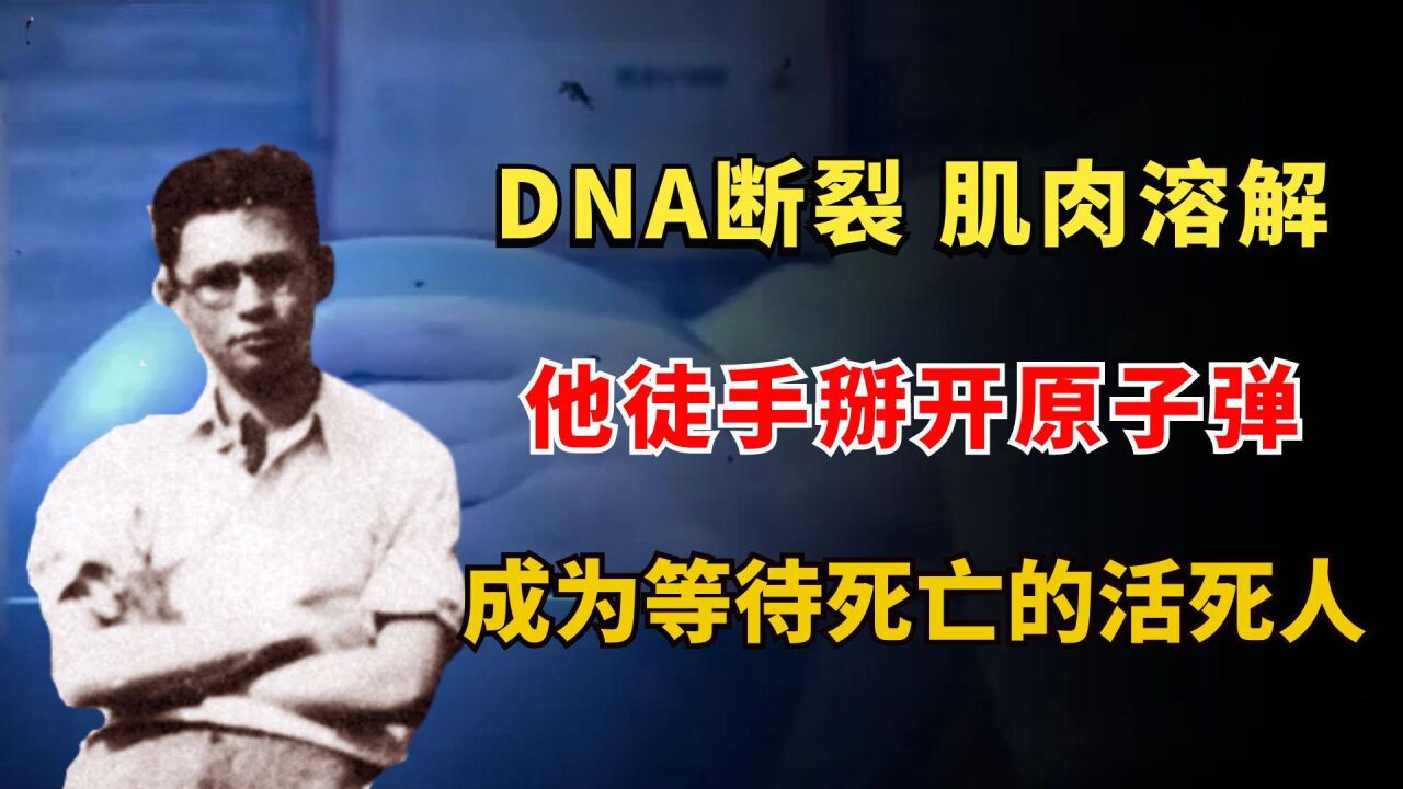 dna断裂,肌肉溶解,他徒手掰开原子弹,却成为等待死亡的活死人