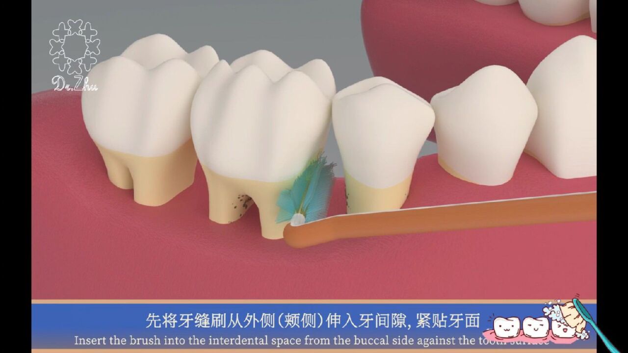 如何使用牙缝刷(牙间隙刷)?