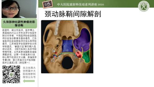 头颈部神经源性肿瘤的影像诊断-中大赵登玲