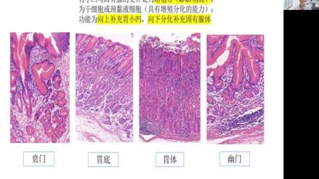 浅谈胃腺瘤病理诊断