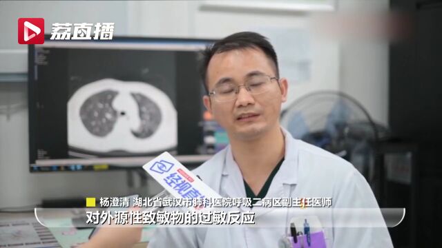 男子喜欢吹奏葫芦丝竟然导致双肺发白,医生紧急提醒