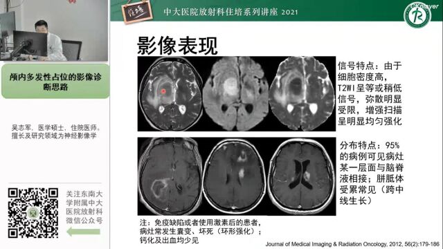 颅内多发占位的影像诊断中大彭志军