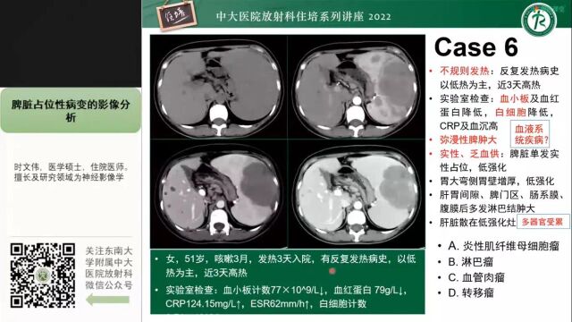 脾脏占位性病变的影像分析中大时文伟