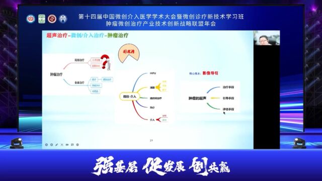 【复旦大学附属华东医院】赵洪教授肿瘤的超声治疗