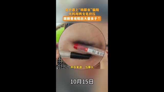 山东青岛女子遭遇“挑眼虫”骗局,揭秘其背后的原理