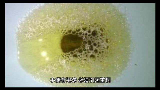 健康活到100岁