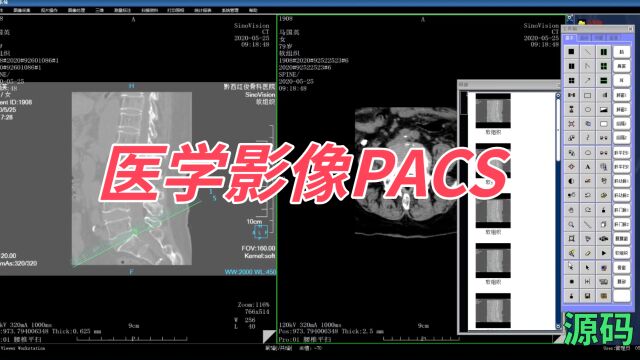 医院PACS影像信息管理系统源码带三维重建