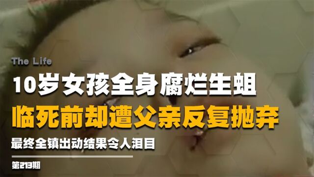 10岁女孩全身腐烂生蛆,死前却遭父亲反复抛弃,最终结果令人泪目