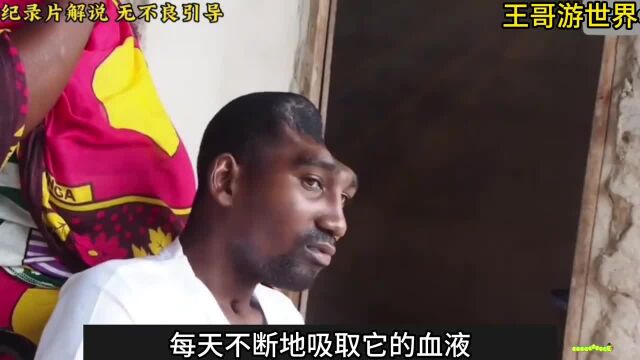 法克油的头部被马蝇幼虫啃噬,每天不断吸取他的血液!