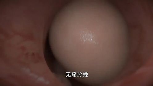 女性分娩为何痛得死去活来？3