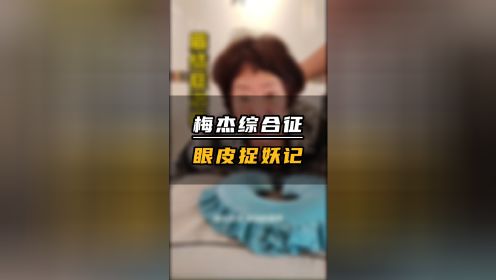 梅杰综合症 眼皮无力下垂 眼睛睁不开 中医 草木医学