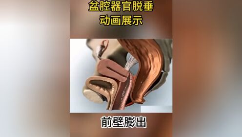 擅長(zhǎng)：女性盆底功能障礙疾病的診治、普通婦科。票販子掛號(hào)無需排隊(duì)，直接找我們快速辦理住院的簡(jiǎn)單介紹