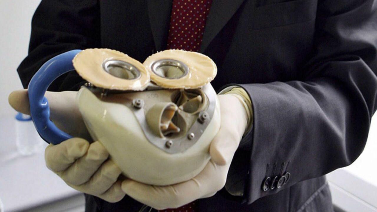 心脏病人有救了！这款人造心脏比真心脏都好，充满电就能用_高清1080P在线观看平台_腾讯视频