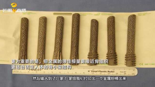 全球首例!3D打印仿生钽金属多孔支架为坏死股骨头换新“梁”