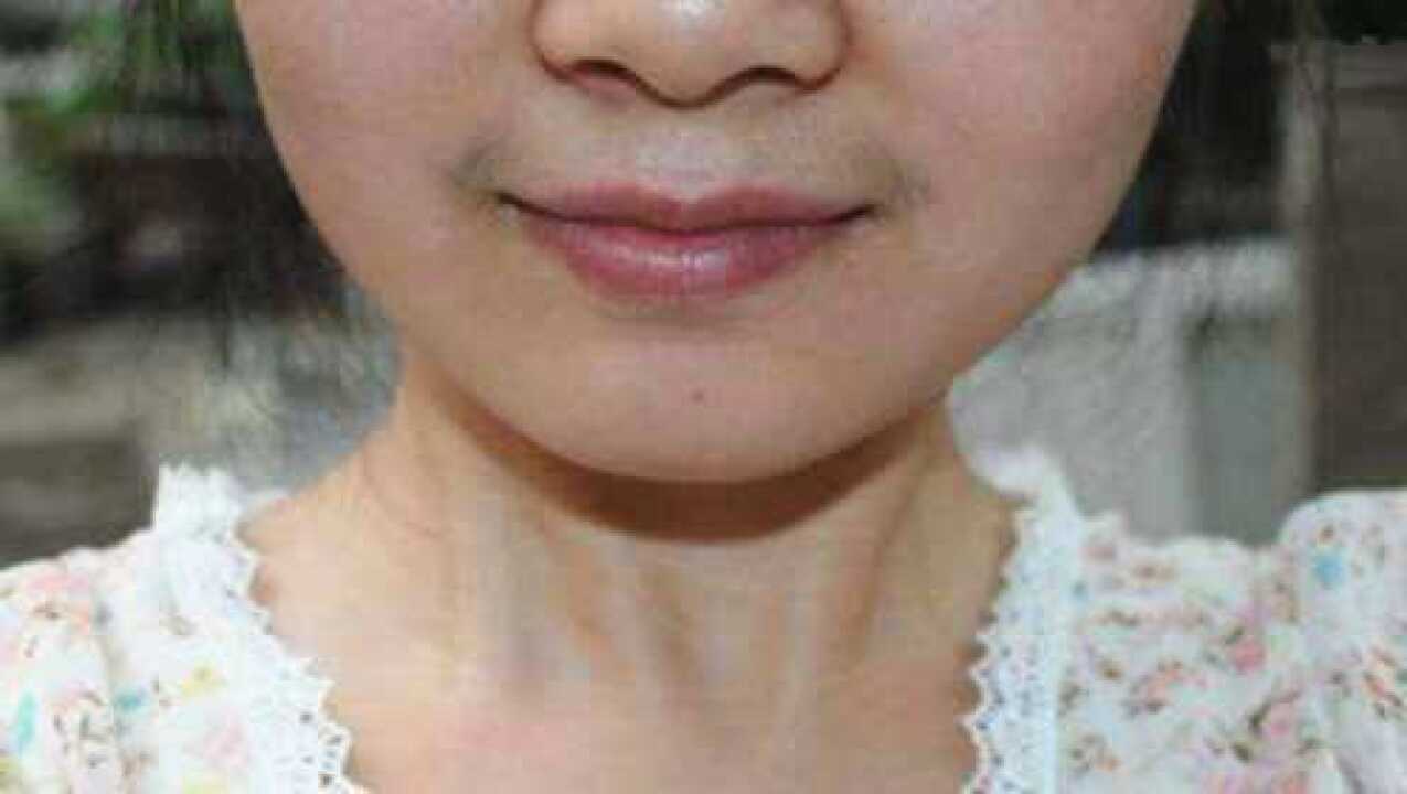 女生老是长小胡子急死人教你一绝招快速去除不再长