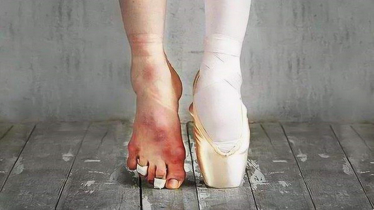 芭蕾舞者的脚变形图片图片