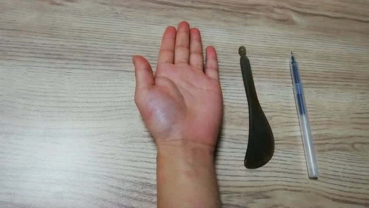 通里穴简易取穴法_高清1080P在线观看平台_腾讯视频