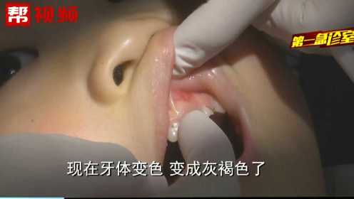 可怜！5岁女童牙齿变色牙龈流脓，医生：因牙神经坏死