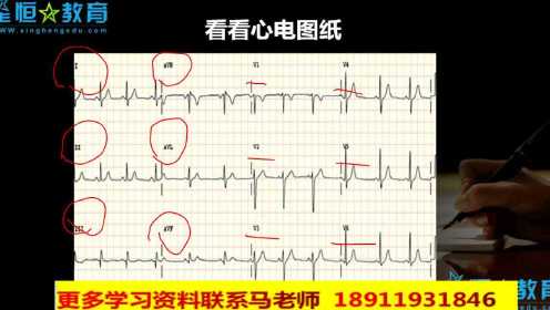 星恒教育免费课程 技能实操讲解 刘江老师 心电图1