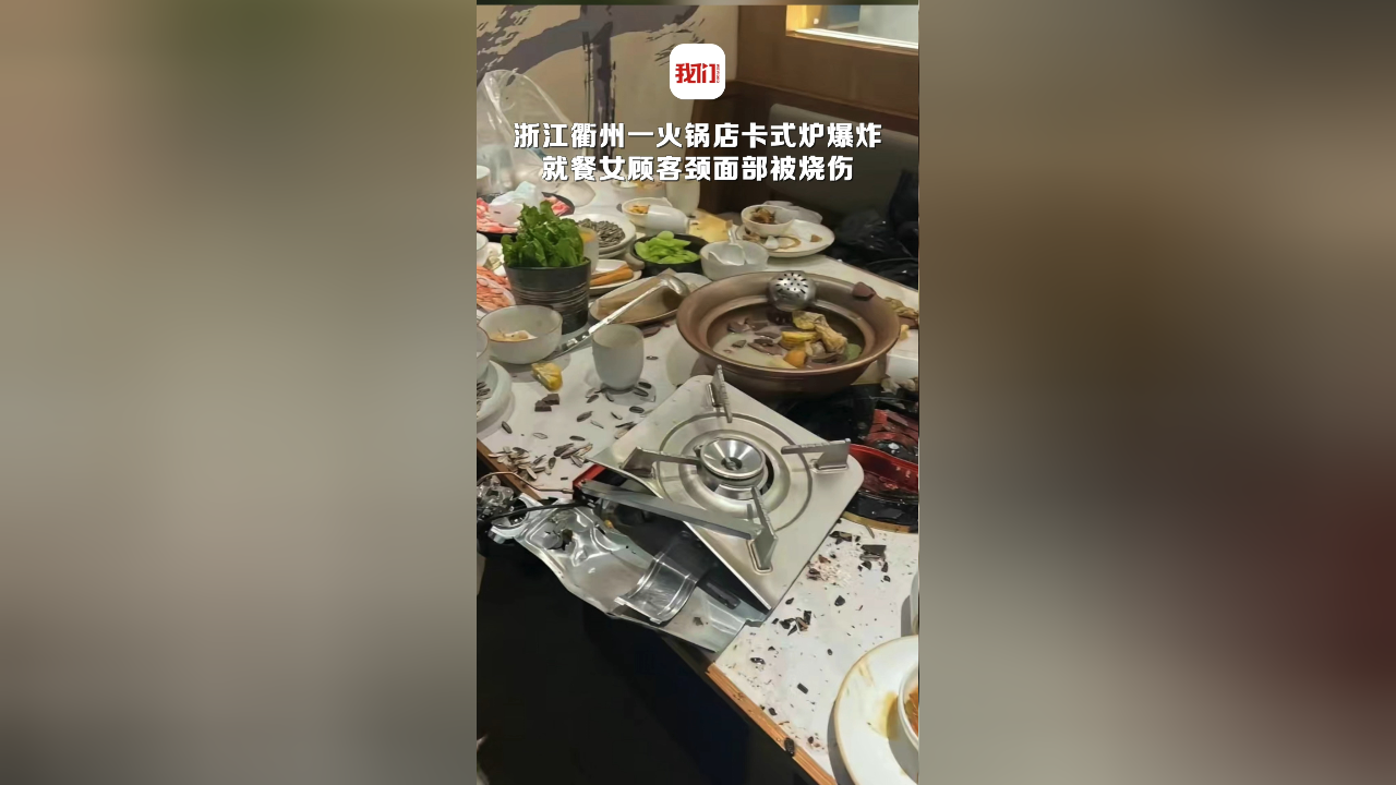 浙江衢州一火锅店卡式炉爆炸 就餐女顾客颈面部被烧伤