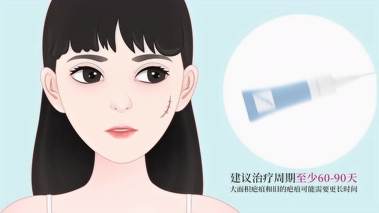 芭克祛疤膏的正确使用方法爱美女生疤痕修复