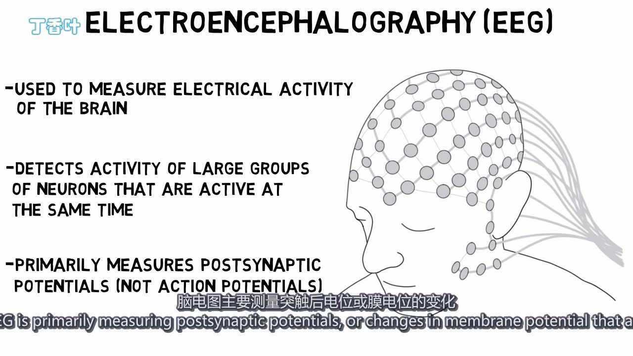 2分钟神经科学-脑电图(EEG)_高清1080P在线观看平台_腾讯视频