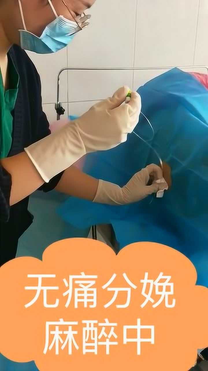 无痛分娩麻醉针竟然这么长一针扎下去看着都疼