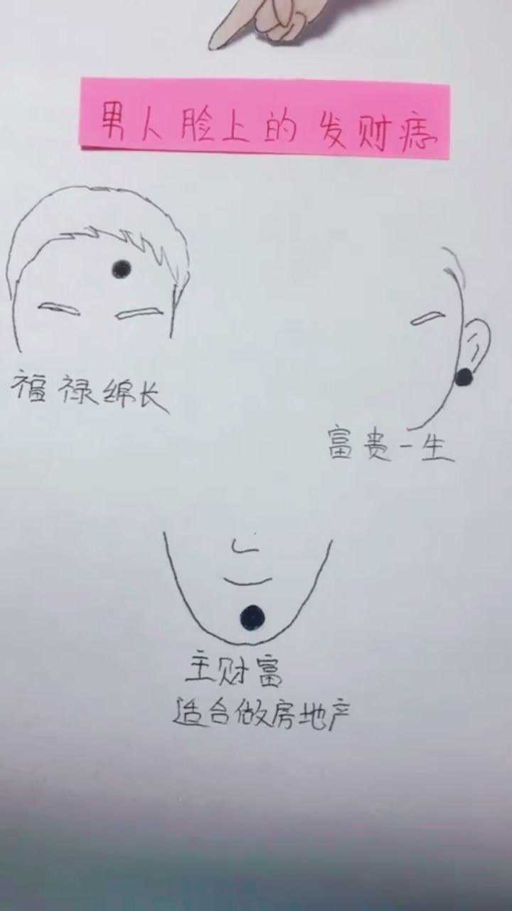 男人脸上的发财痣!