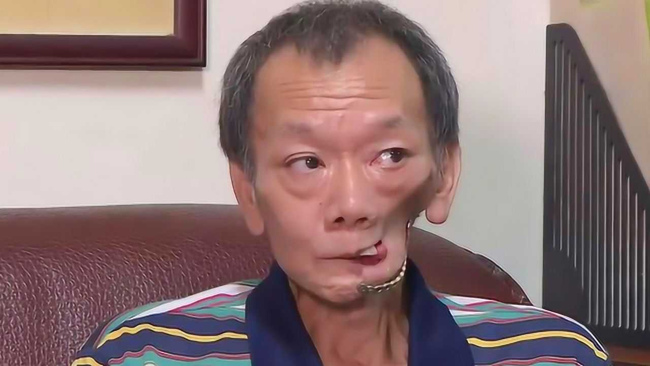 槟榔危害有多大农村大叔嚼槟榔13年如今连水都喝不下了