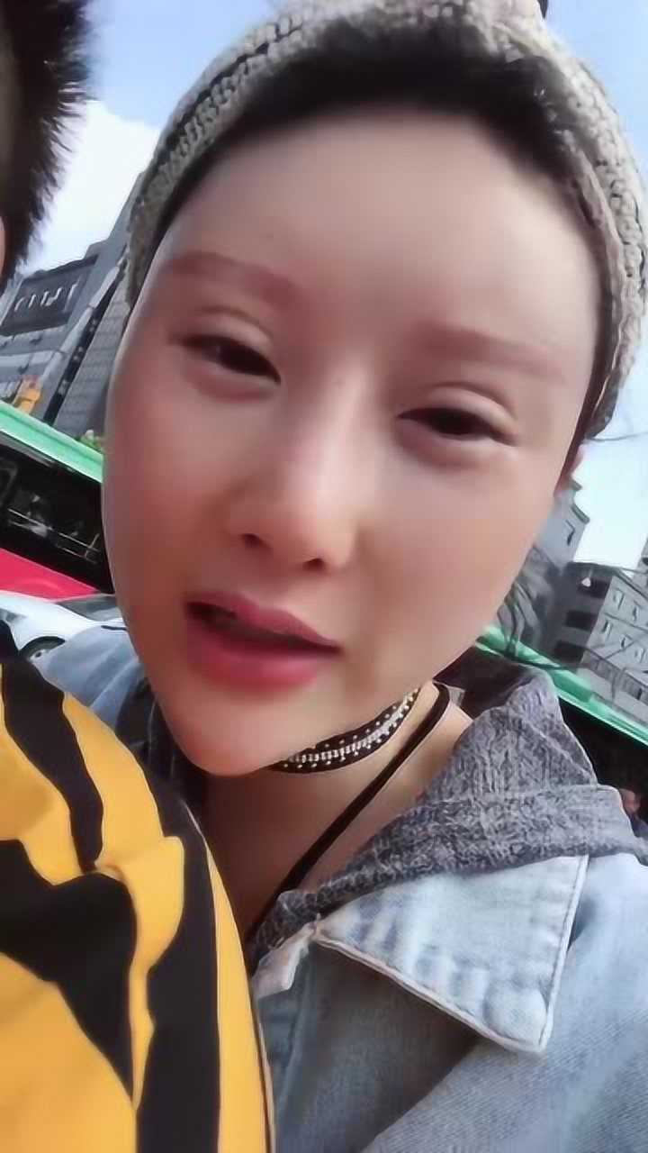美女网红整容失败的案例,这眼睛就够吓人的,上下都有双眼皮
