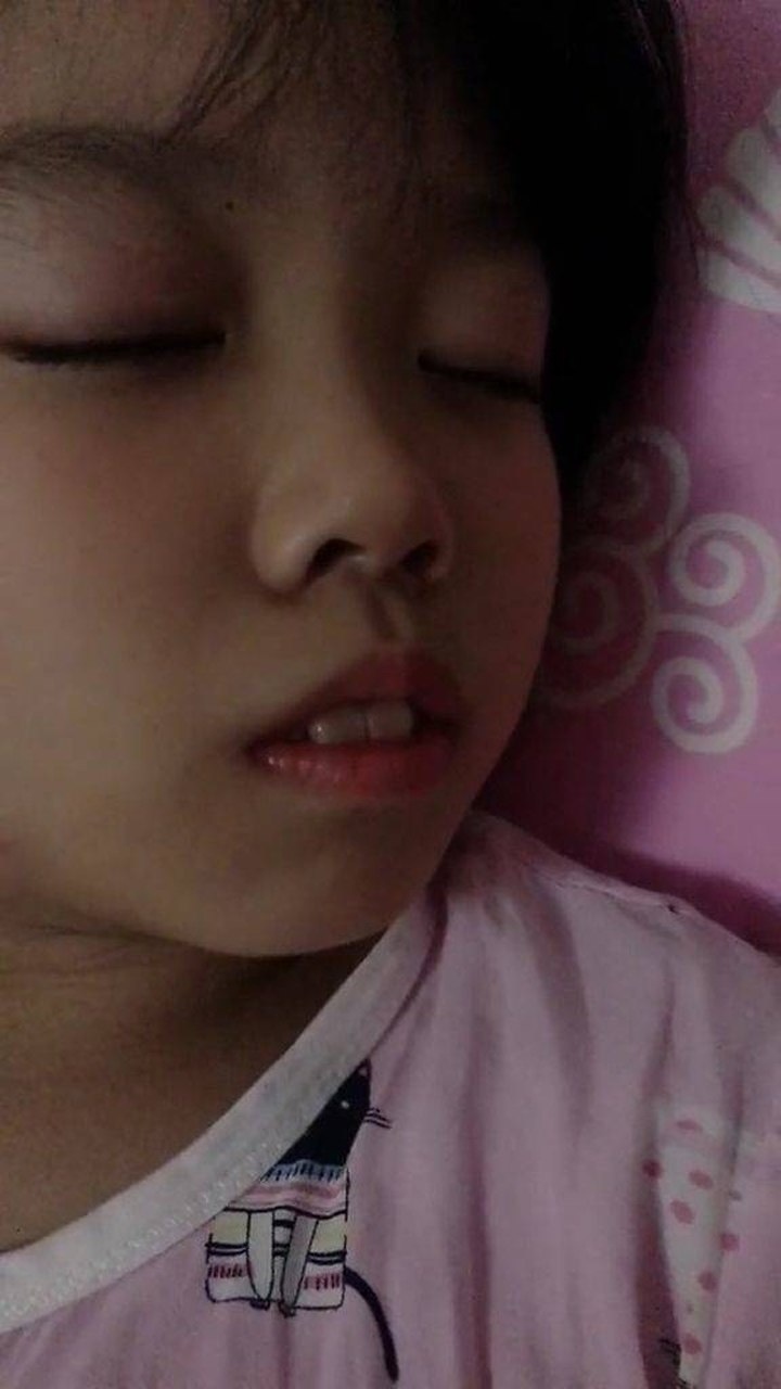 儿童张嘴睡觉变丑图片图片