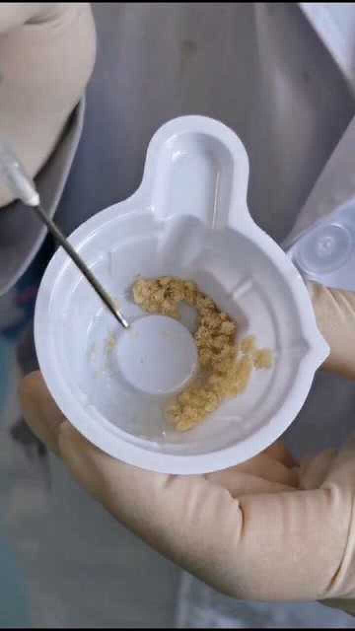 医用蛆虫治疗溃烂伤口?你敢用这种治疗方式吗?