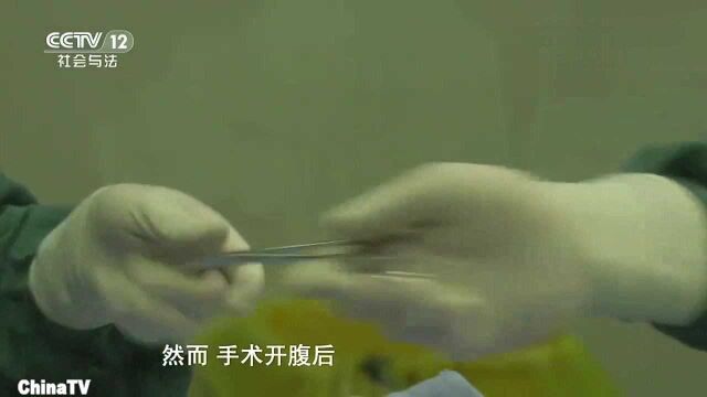 回顾:为救英雄整座城调血,献血达5.88万毫升!手术8小时能否救回英雄