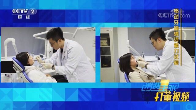 电动牙刷和手动牙刷哪个刷得更干净?医生进行对比实验