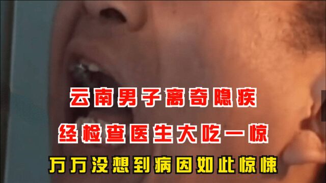 云南男子离奇隐疾,经检查医生大吃一惊,万万没想到病因如此惊悚