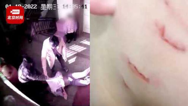 警方回应女子拳打脚踢邻居11岁男孩:正在调查 将去医院取证