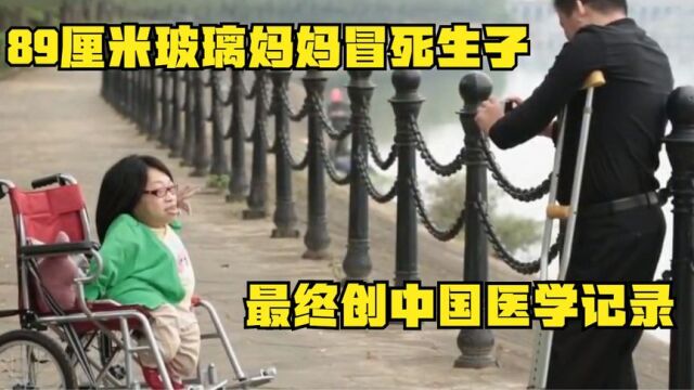 89厘米玻璃妈妈冒死生子,过程令人揪心,最终创中国医学记录