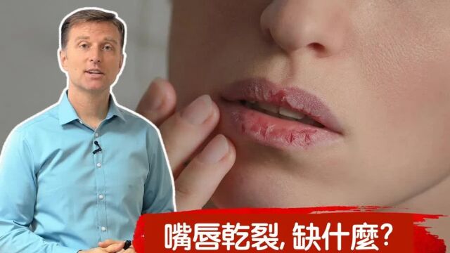 嘴唇乾裂,缺什麽维生素 自然疗法, 柏格医生 Dr Berg