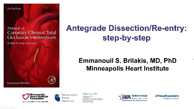 Antegrade dissection and reentry stepbystep