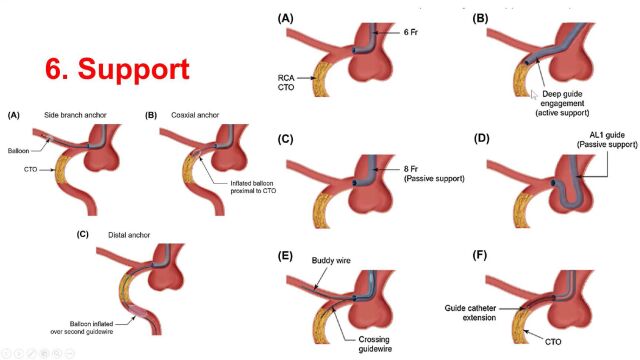 Fundamentals of CTO PCI